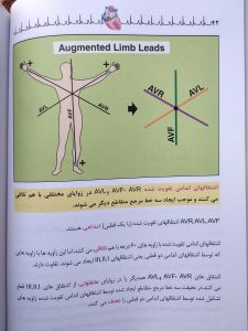 اشتقاق های اندامی تقویت شده ( خواندن فوری الکتروکاردیوگرام دیل دوبین )