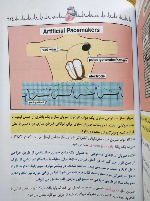 ضربان ساز مصنوعی (خواندن فوری الکتروکاردیوگرام دیل دوبین )